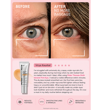 Instant Eye Tightener
