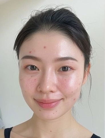 After